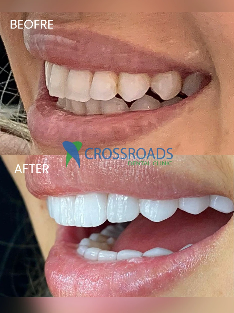 Crossroads Dental Clinic - Sheikh Zayed Road gallery content 3